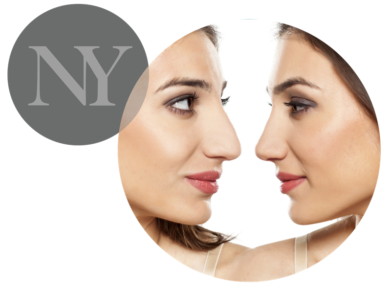 Rhinoplasty Header