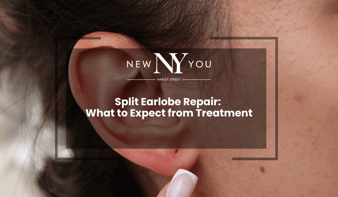 Split Earlobe Repair: What to Expect from Treatment