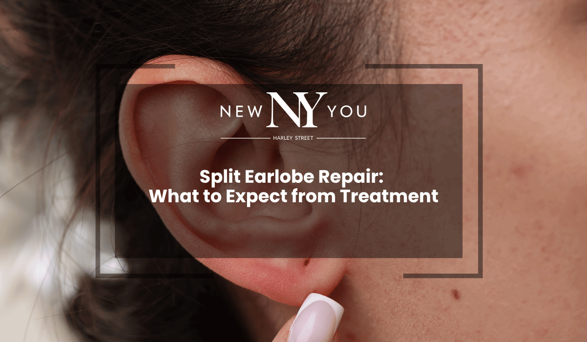 Split Earlobe Repair: What to Expect from Treatment — New You Harley Street