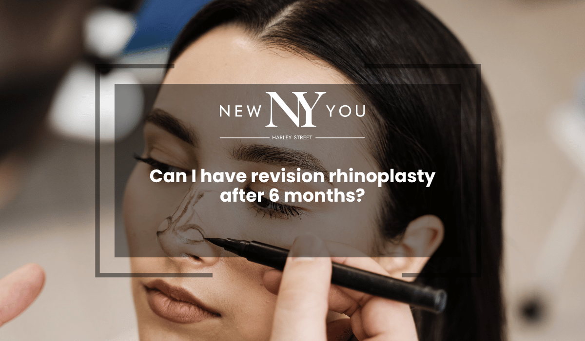 Can I have revision rhinoplasty after 6 months?