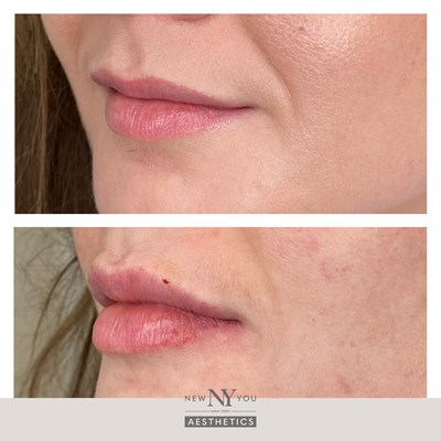 Before And Afters Branded Lips 59