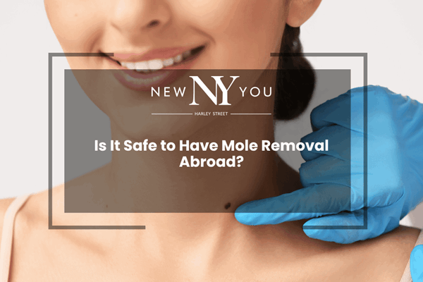 Is It Safe to Have Mole Removal Abroad?