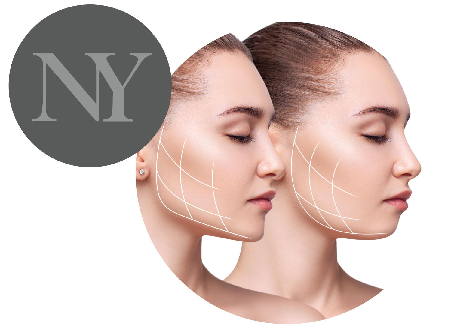 Face Procedures at New You Image