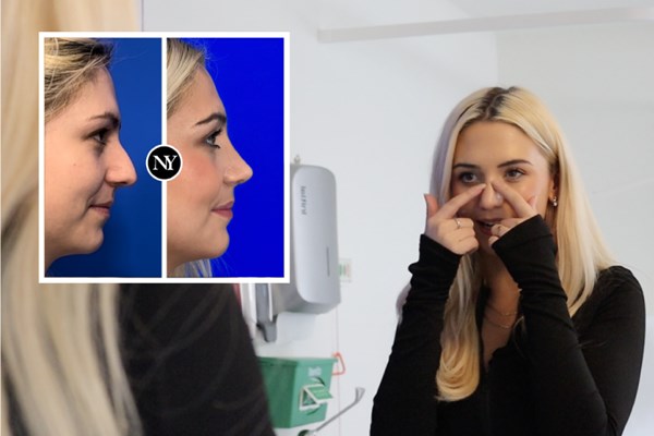 Ultrasonic Septo-Rhinoplasty
