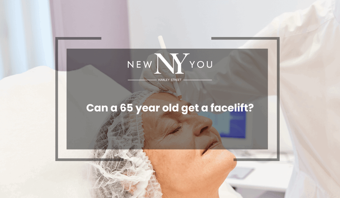 Can a 65 year old get a facelift?