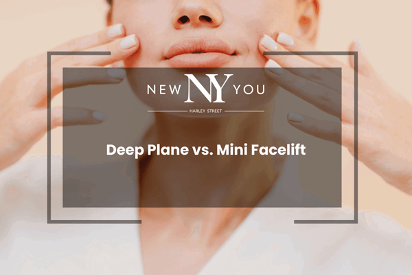 Deep Plane vs. Mini Facelift