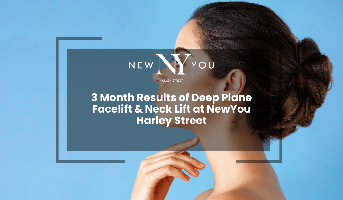 3 Month Results of Deep Plane Facelift & Neck Lift at NewYou Harley Street