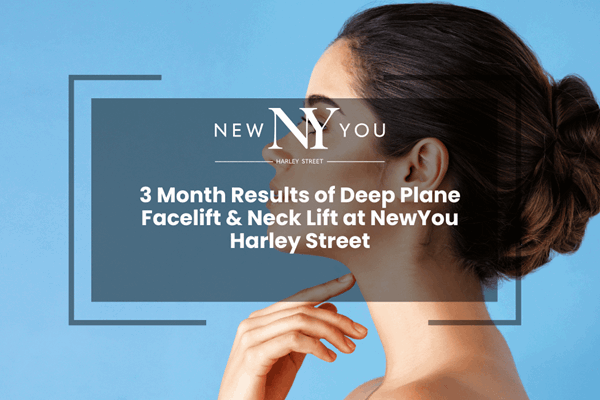 3 Month Results of Deep Plane Facelift & Neck Lift at NewYou Harley Street