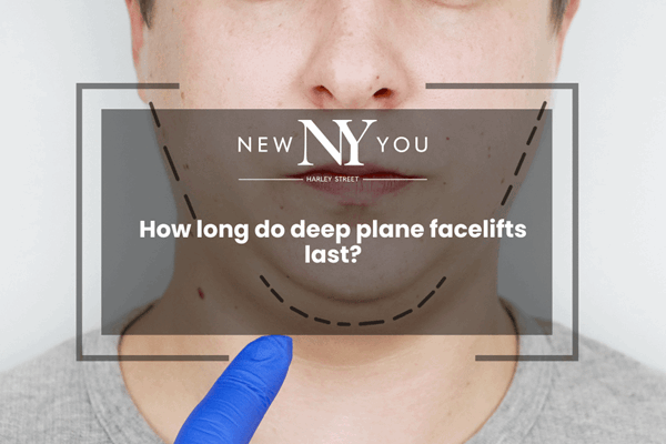 How long do deep plane facelifts last?