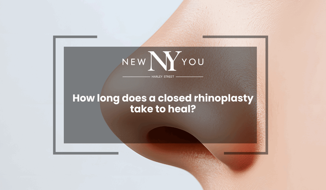 How long does a closed rhinoplasty take to heal?