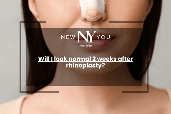Will I look normal 2 weeks after rhinoplasty?