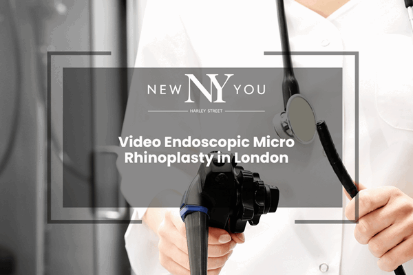 Video Endoscopic Micro Rhinoplasty in London