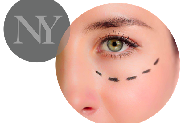 Lower Blepharoplasty