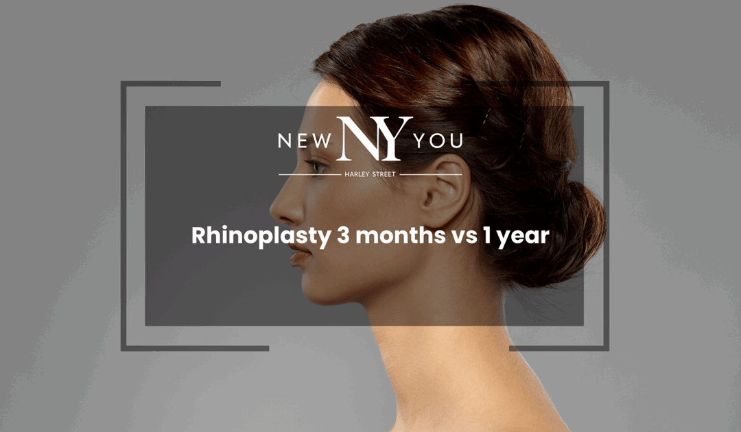Rhinoplasty 3 months vs 1 year