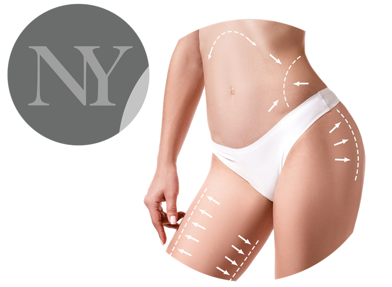 Vaser Liposuction