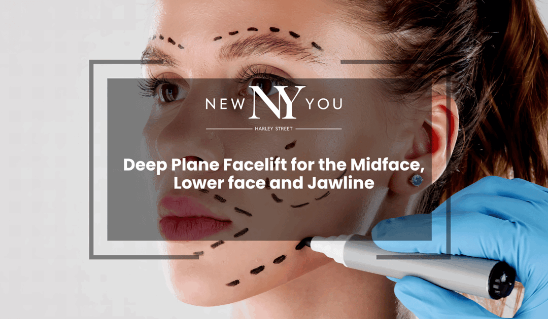 Deep Plane Facelift for the Midface, Lower face and Jawline