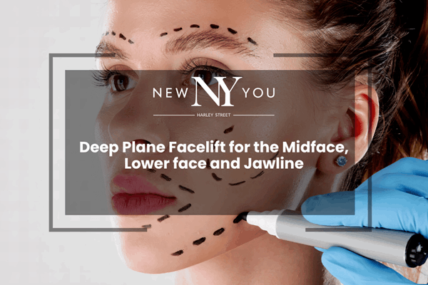 Deep Plane Facelift for the Midface, Lower face and Jawline