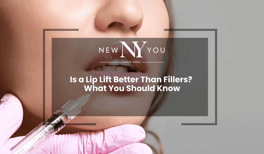 Is a Lip Lift Better Than Fillers? What You Should Know