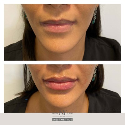 Before And Afters Branded Lips 70