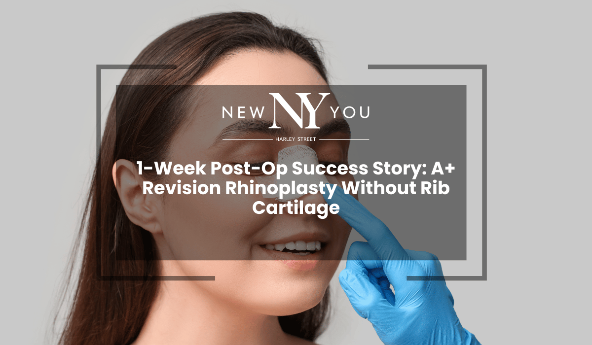 1-Week Post-Op Success Story: A+ Revision Rhinoplasty Without Rib Cartilage