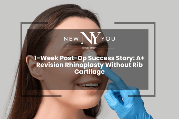 1-Week Post-Op Success Story: A+ Revision Rhinoplasty Without Rib Cartilage